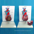 Modèle médical de démonstration anatomique cardiaque avec description (R120107)